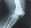 Orthopaedics Image